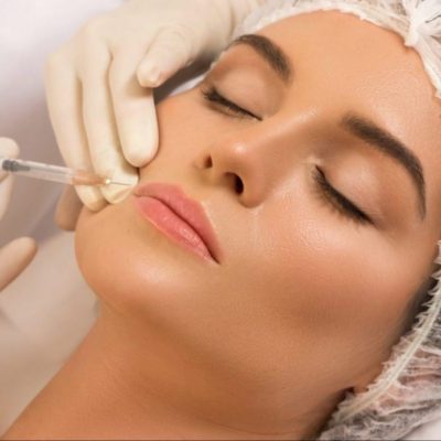 Essential Points To Consider Before Injecting Dermal Fillers